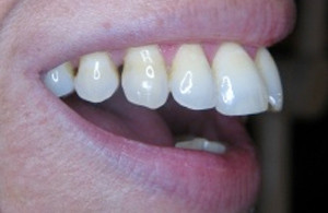 Mondzorg Dental Beauty / Paradontale behandelingen