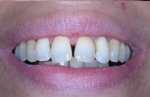 Mondzorg Dental Beauty / Paradontale behandelingen